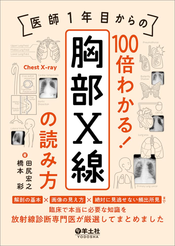 医師1年目からの 100倍わかる！ 胸部X線の読み方〜解剖の基本 ✕ 画像