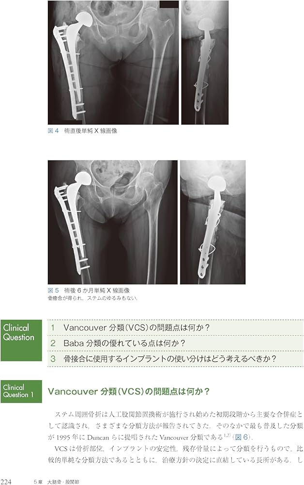 Amazon.co.jp: クリニカル・クエスチョンで考える外傷整形外科ケース