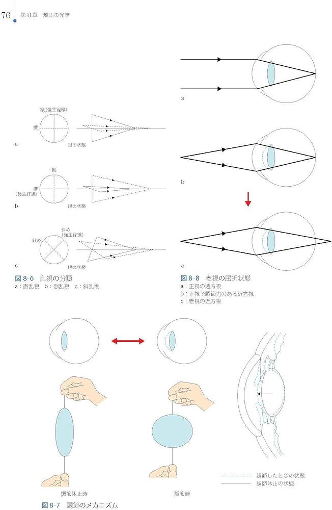 Amazon.co.jp: 光学・眼鏡 (視能学エキスパート) : 公益社団法人 日本