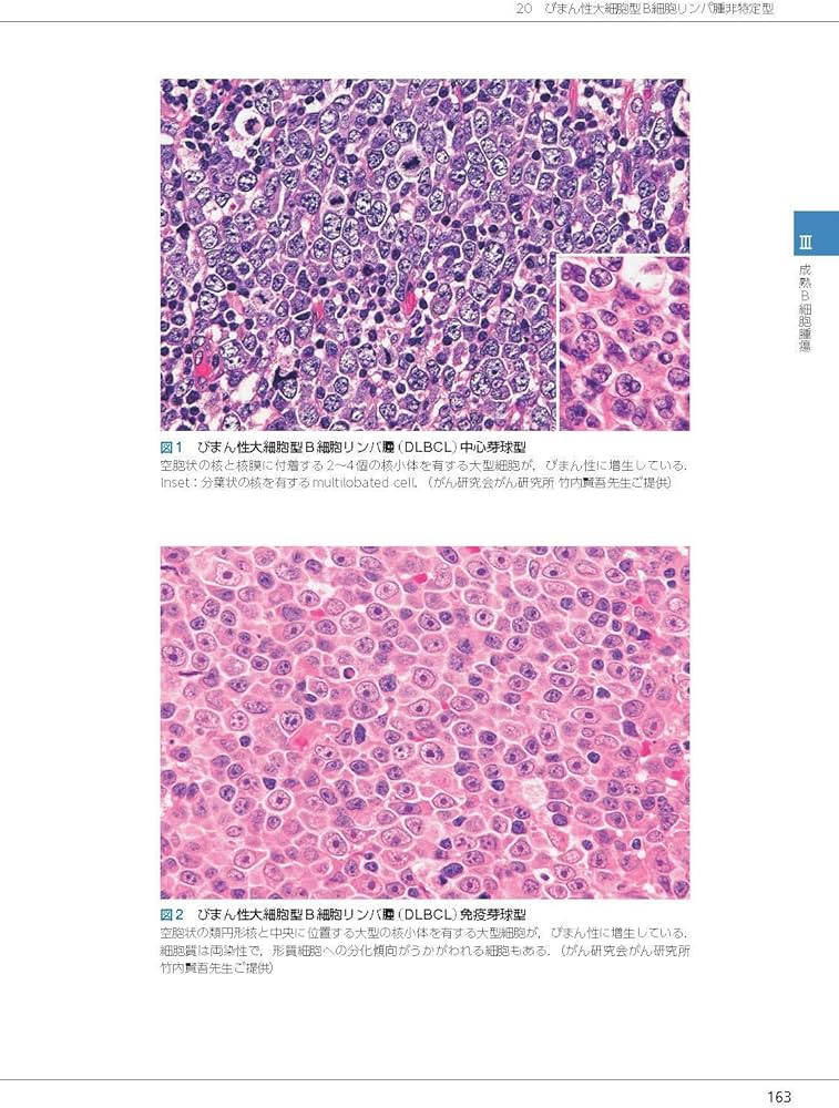 リンパ腫アトラス 第6版 | 中村直哉, 大島孝一, 加留部謙之輔, 佐藤