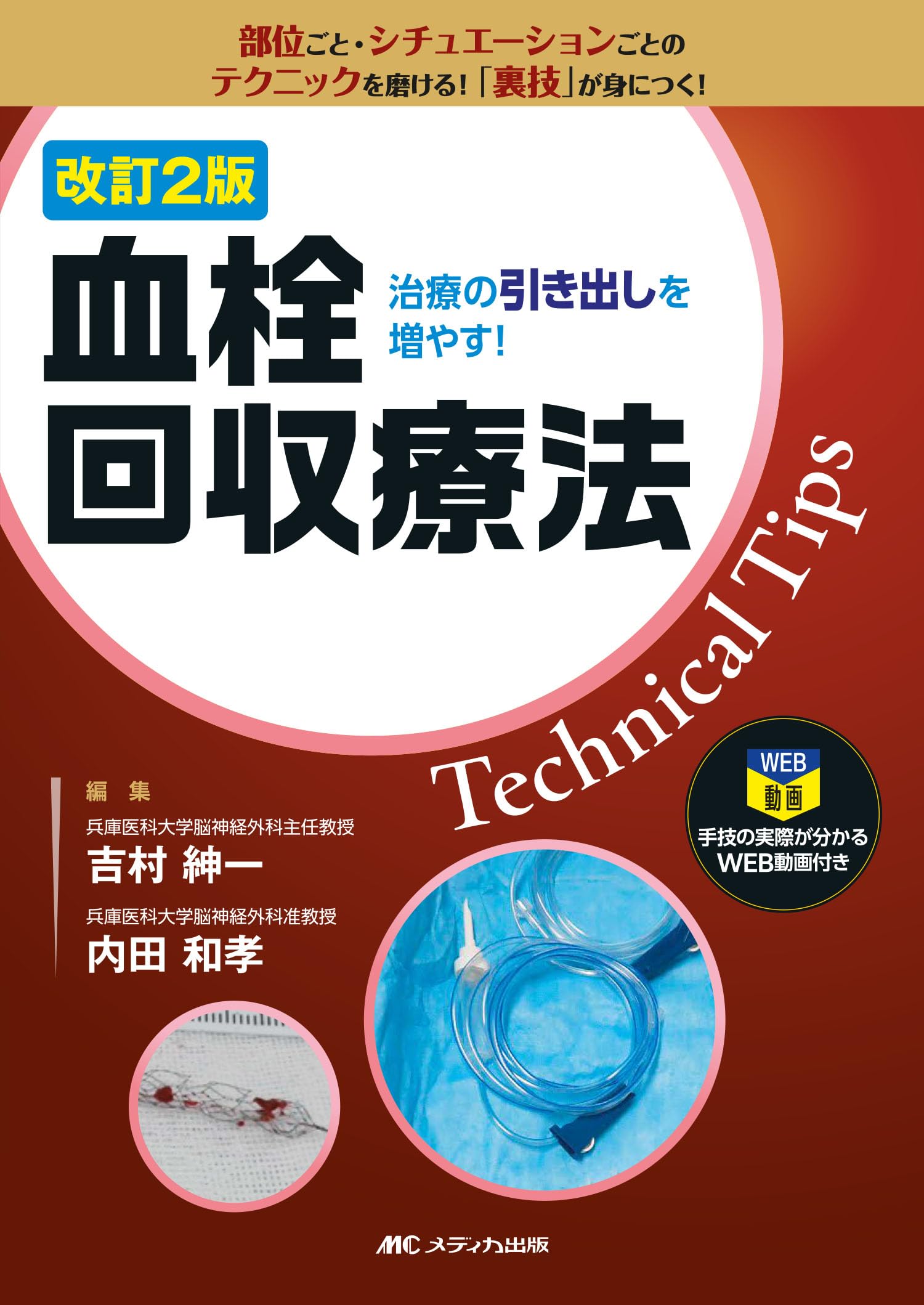改訂2版 血栓回収療法Technical Tips：治療の引き出しを増やす！／手技
