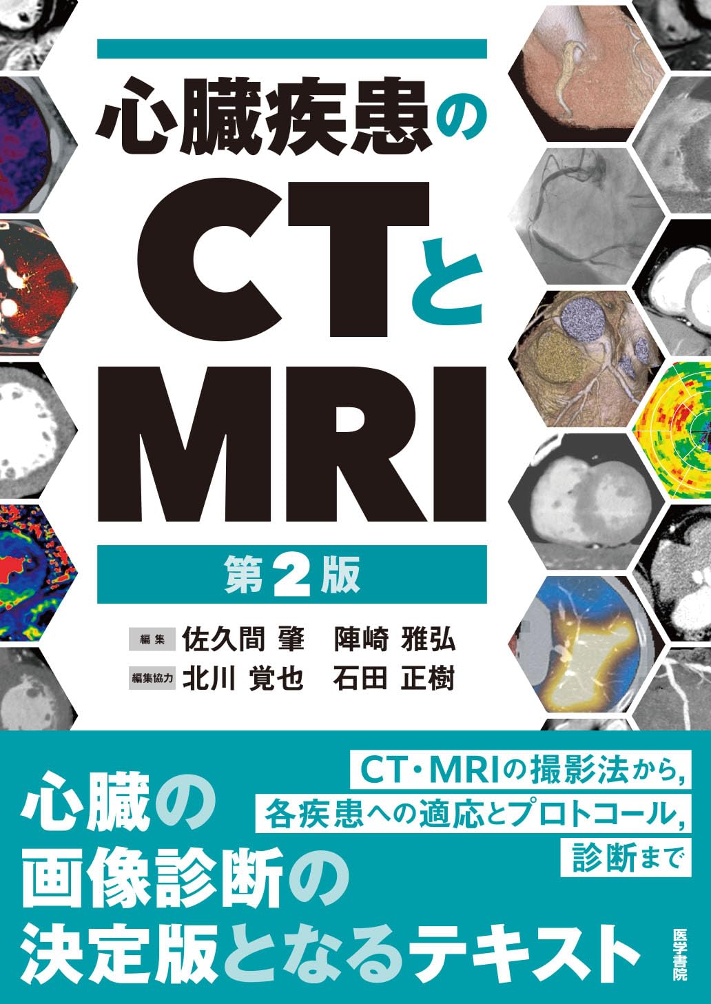 心臓疾患のCTとMRI 第2版 | 佐久間肇, 陣崎雅弘, 北川覚也, 石田正樹