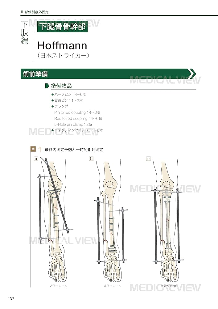 一時的創外固定マニュアル | 日本四肢再建・創外固定学会 |本 | 通販