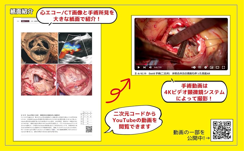心臓手術ビデオアトラス 手術手技と画像診断［Web動画付］ | 江石清行