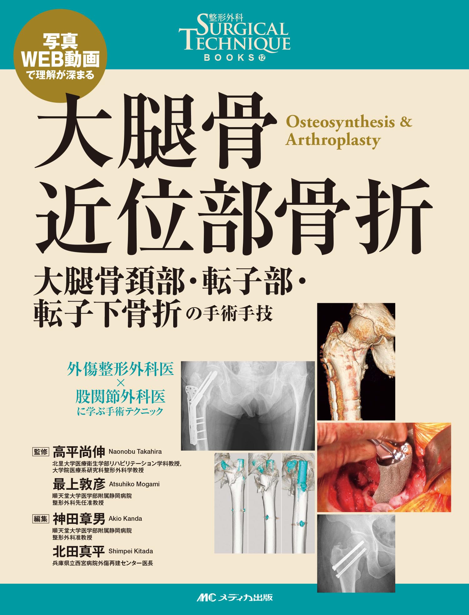 大腿骨近位部骨折：大腿骨頚部・転子部・転子下骨折の手術手技 (整形