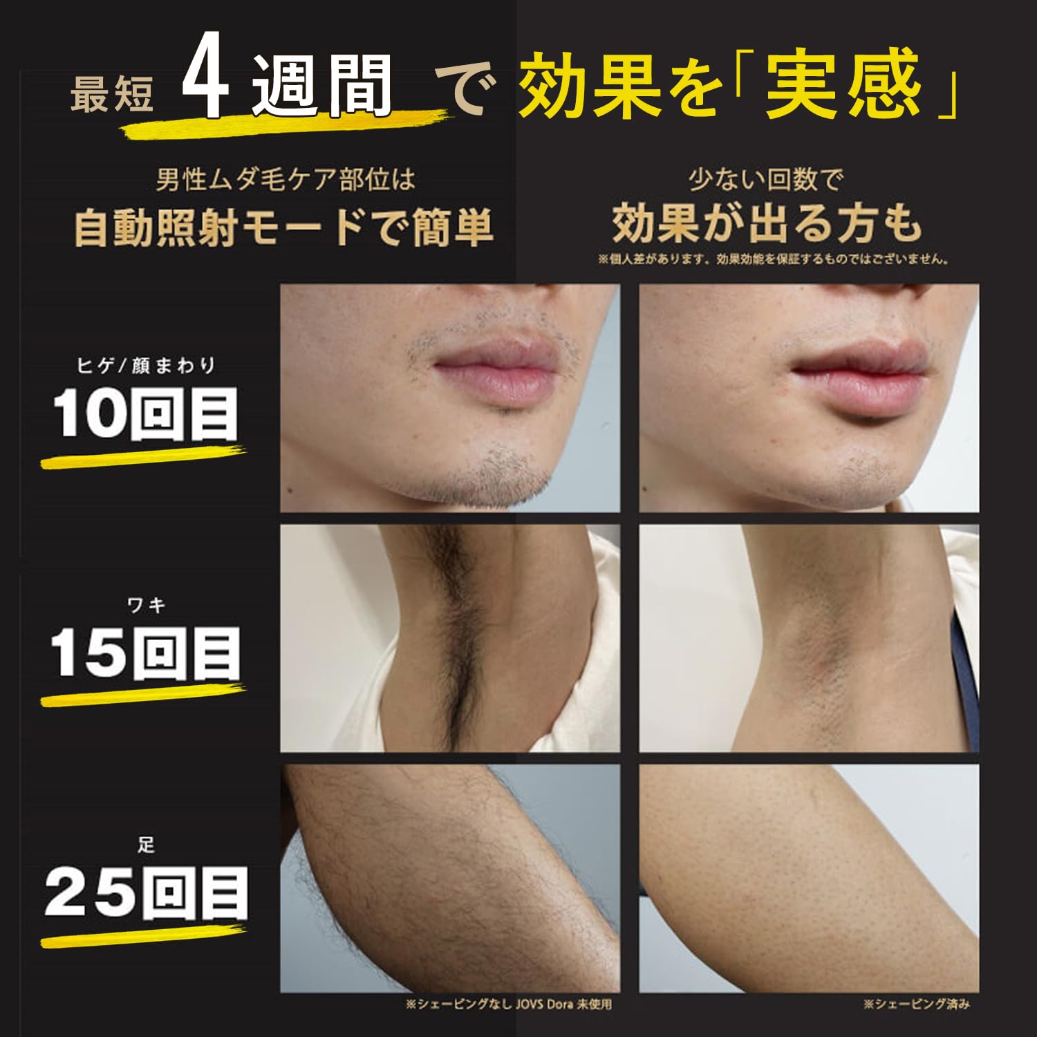 Amazon | JOVS Dora SRモード搭載 脱毛器 家庭用 光美容器 VIO対応 だ