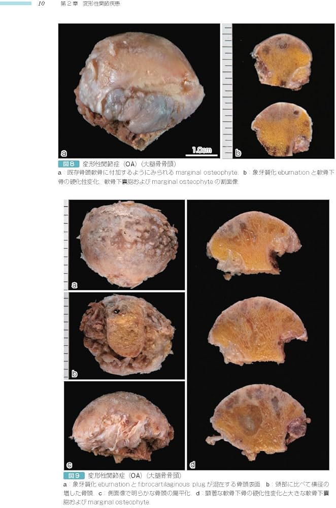 Amazon.co.jp: 非腫瘍性疾患病理アトラス 骨関節 : 石田 剛, 今村哲夫