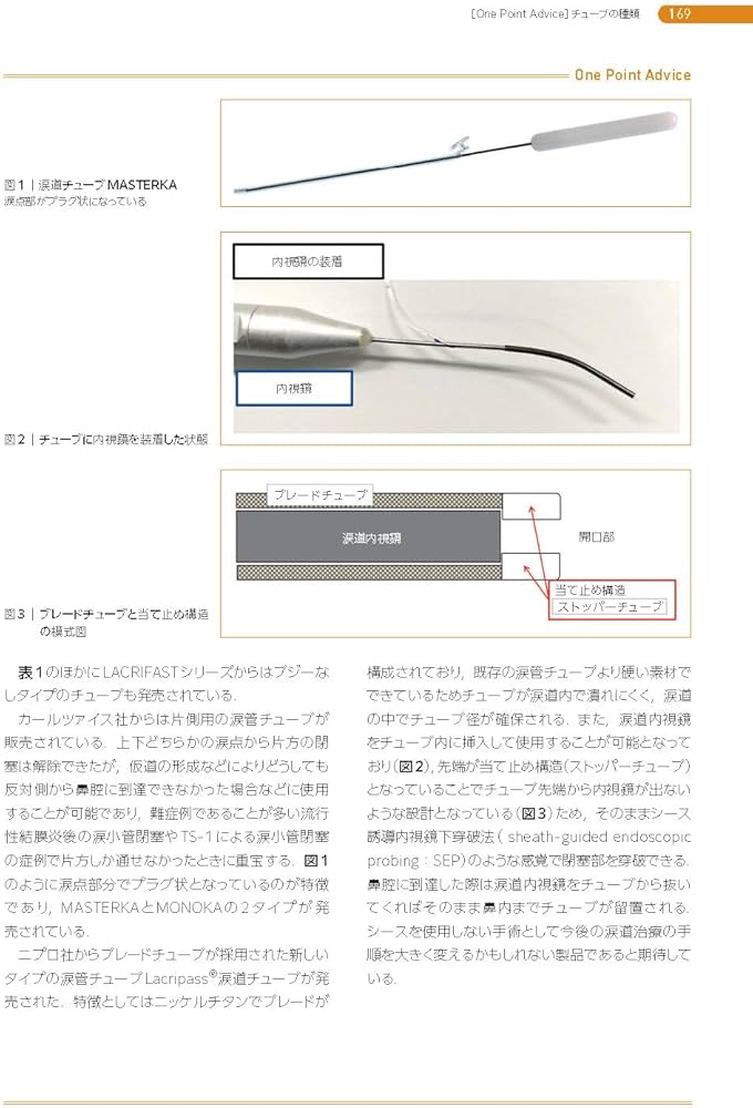 Amazon.co.jp: 涙道診療オールインワン (新篇眼科プラクティス 18