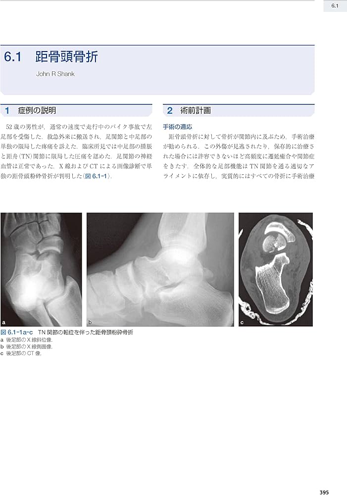 AO法骨折治療 Foot and Ankle [英語版Web付録付] (AOTRAUMA) | Stefan