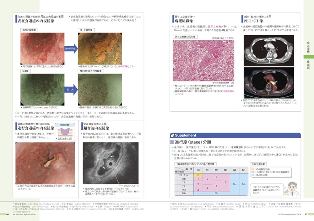 病気がみえる 〈vol.1〉 消化器: 9784896326123: Books - Amazon.ca