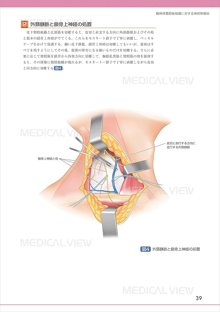 71U5rll12yL._AC_UF1000,