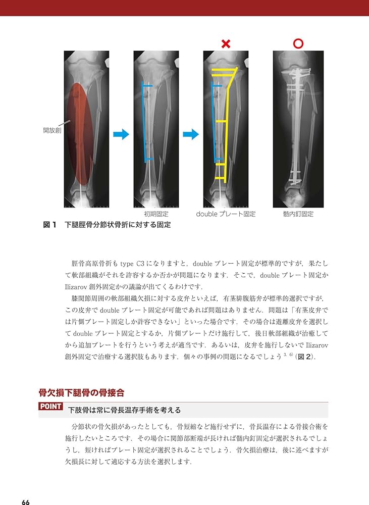 重度四肢外傷治療の奥義 | 土田芳彦 |本 | 通販 | Amazon