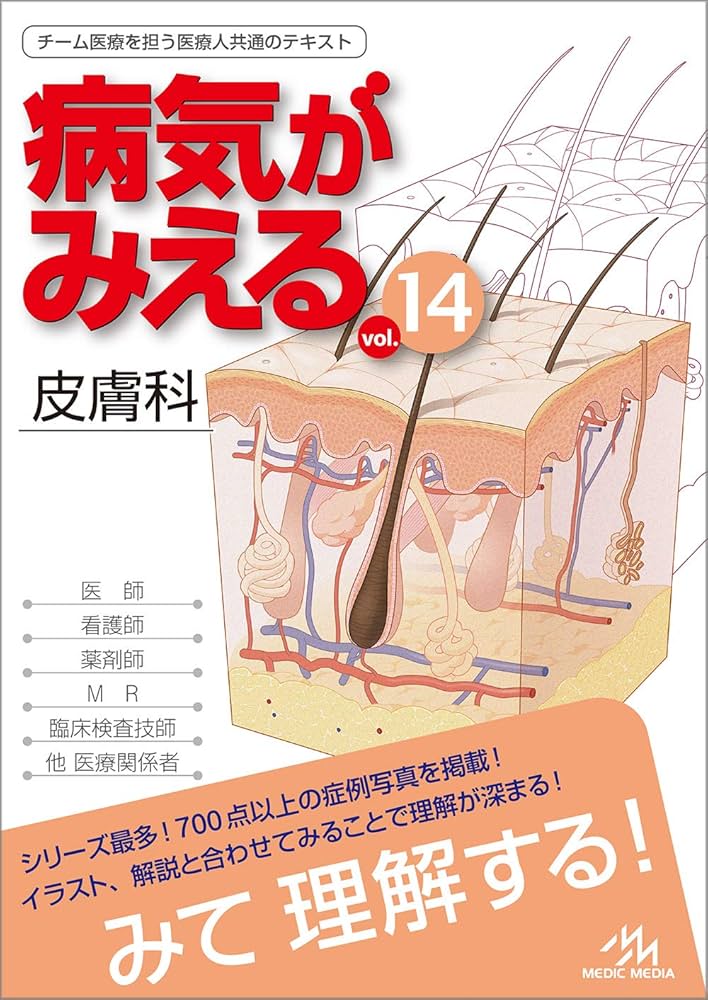病気がみえる vol.14 皮膚科 第1版 | 医療情報科学研究所 |本 | 通販