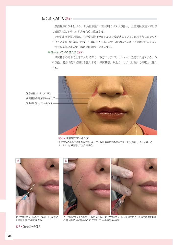 顔の美容外科手術 第2版 | 飯田秀夫 |本 | 通販 | Amazon