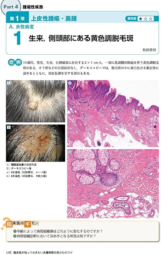 病理像+臨床写真で一目でわかる! 臨床医が知っておきたい皮膚病理の見