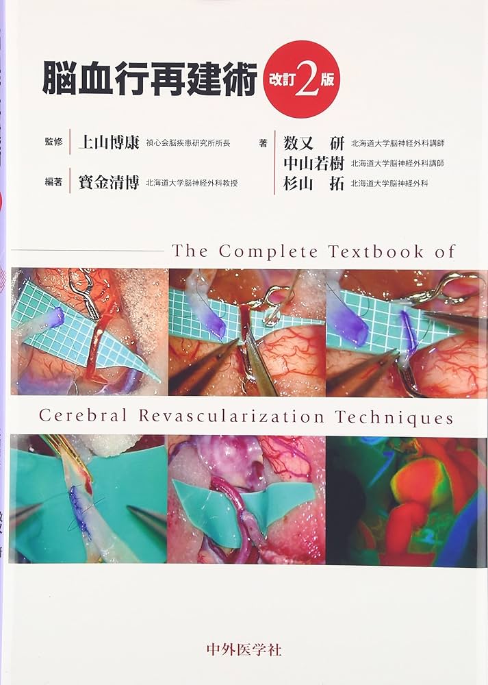 脳血行再建術 改訂2版 | 寳金 清博 |本 | 通販 | Amazon