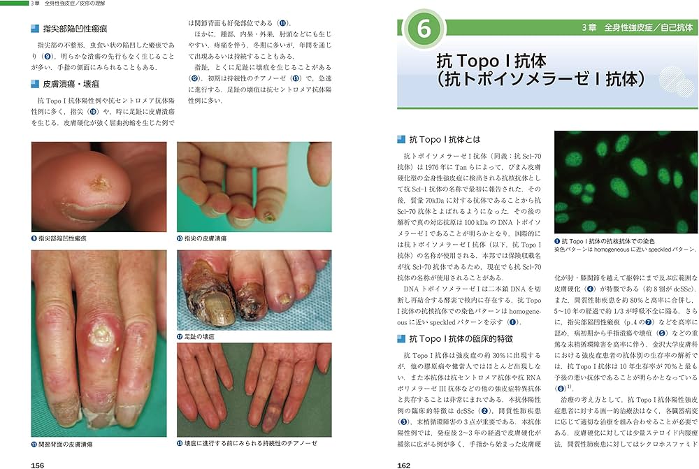 皮膚科 膠原病ー皮疹から全身を診る (皮膚科ベストセレクション