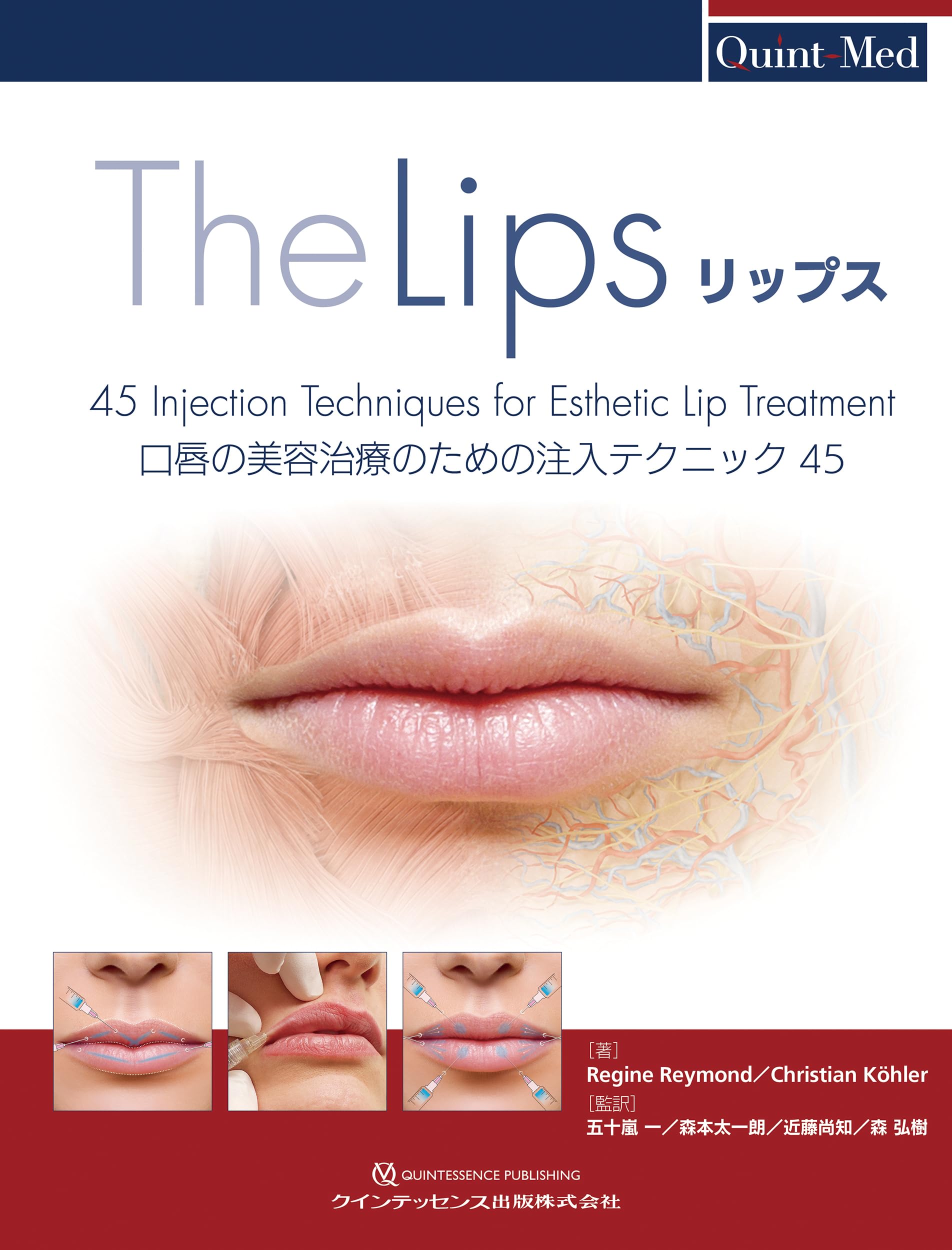 リップス: 口唇の美容治療のための注入テクニック45 (Quint-Med