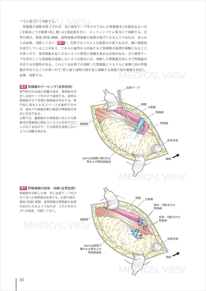 オープンサージャリ一 (Urologic Surgery Next 4) | 土谷 順彦 |本
