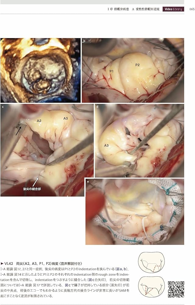 心臓手術ビデオアトラス 手術手技と画像診断［Web動画付］ | 江石清行
