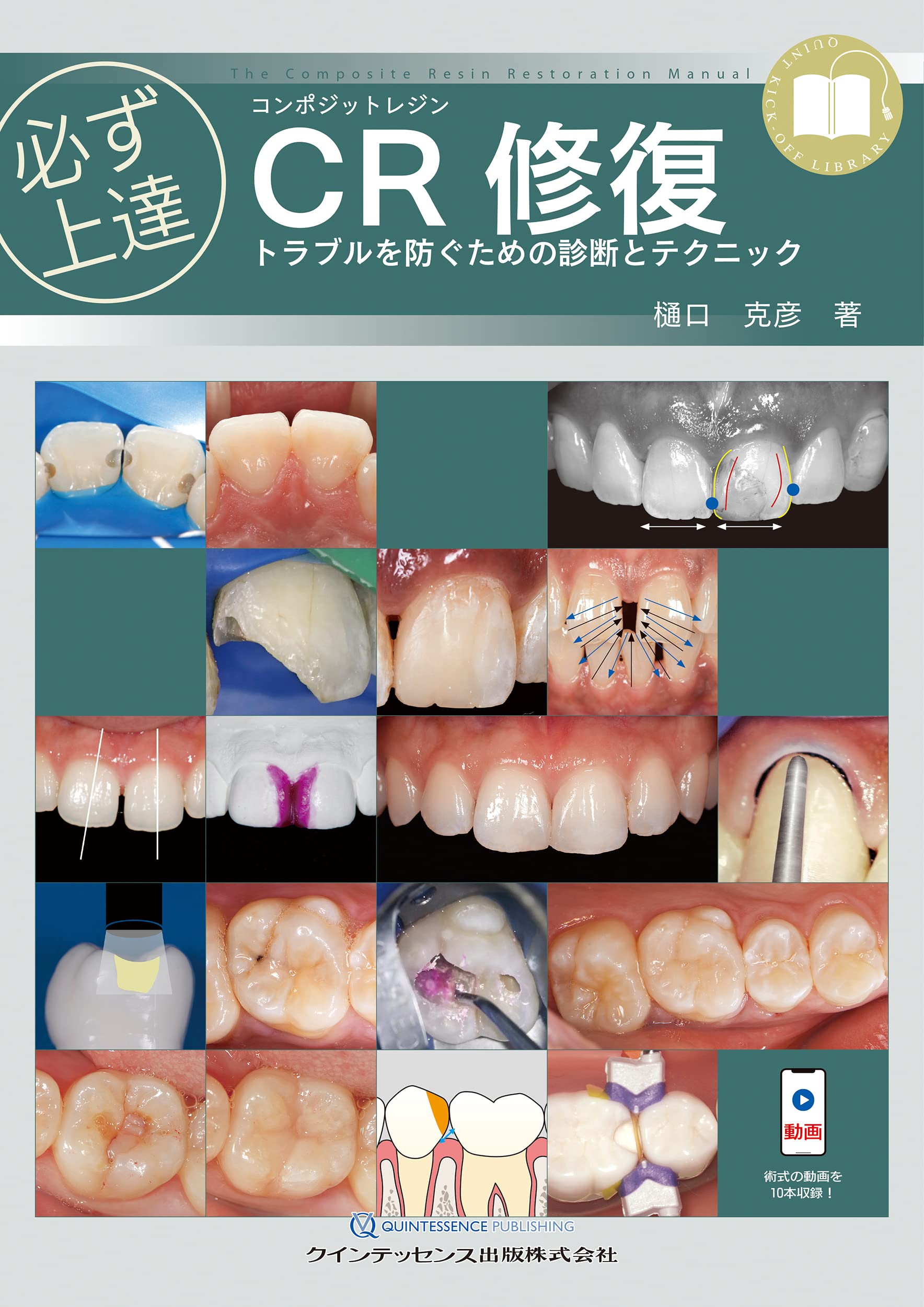 必ず上達 デジタル時代の歯冠修復 最終値下げ 必ず上達 デジタル時代の