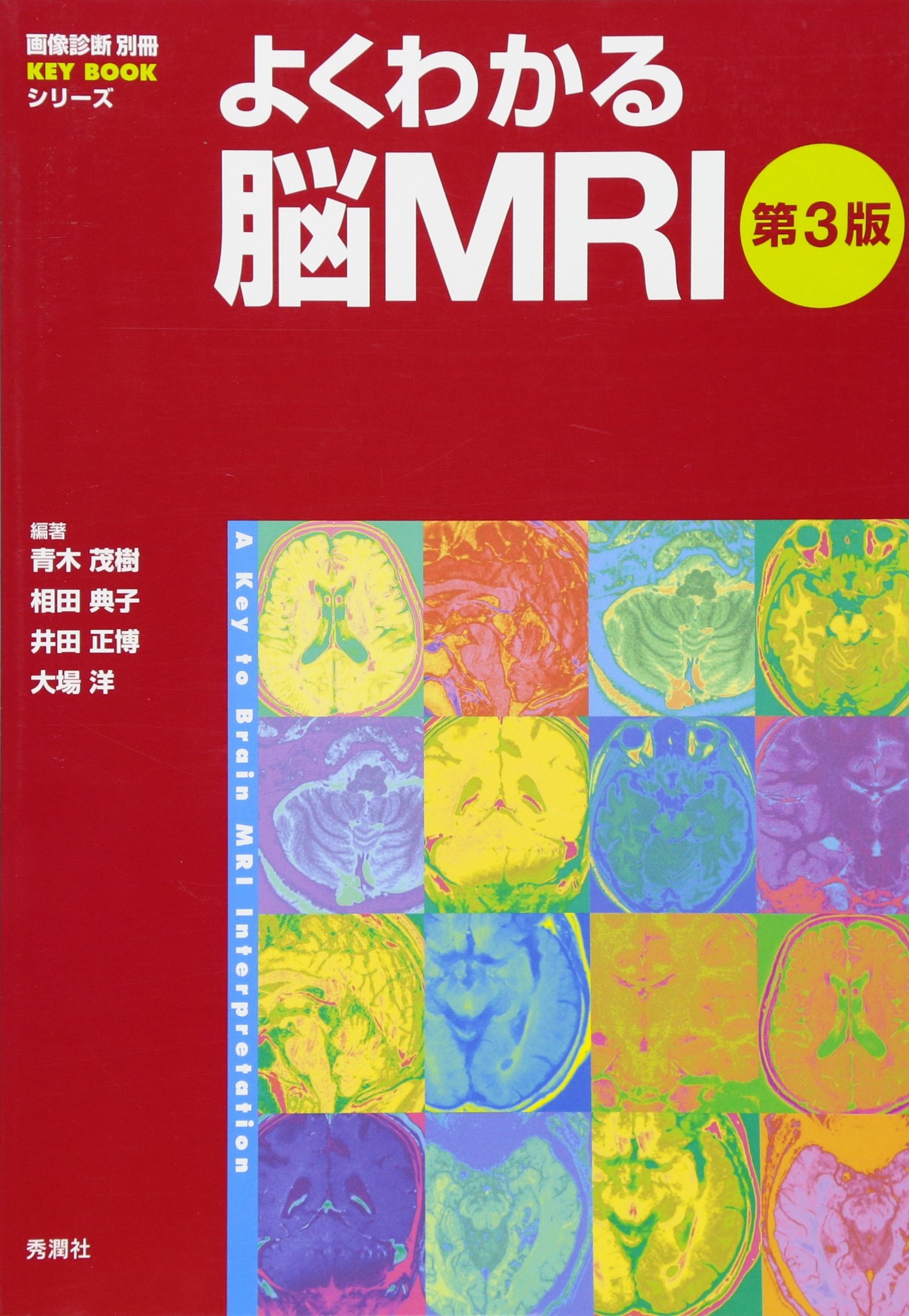Amazon.co.jp: よくわかる脳MRI 第3版 (画像診断別冊KEYBOOK) : 青木