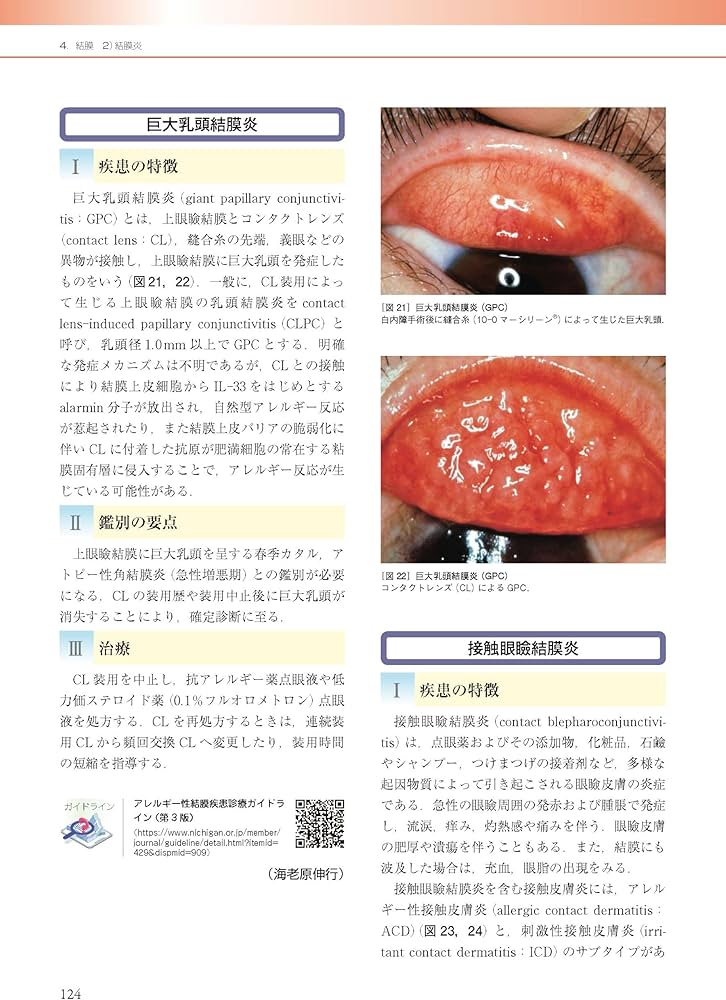 眼科診療ガイド 第2版 | 根木 昭 |本 | 通販 | Amazon