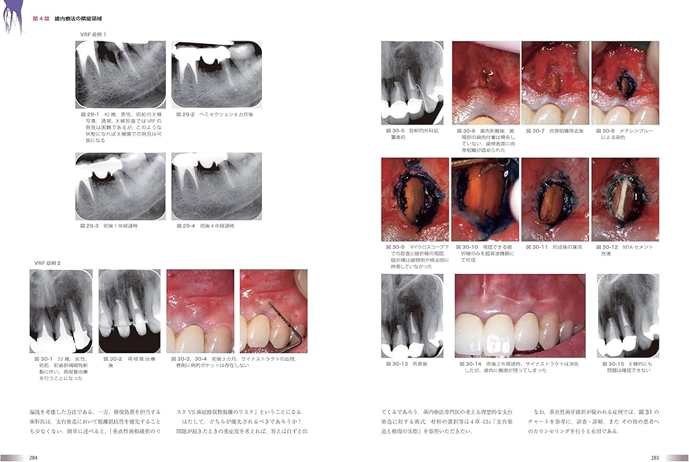 世界基準の臨床歯内療法 | 石井 宏 |本 | 通販 | Amazon