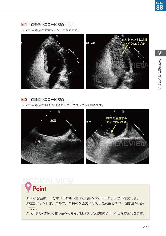 新 今さら聞けない心エコー図 | 田中 秀和 |本 | 通販 | Amazon
