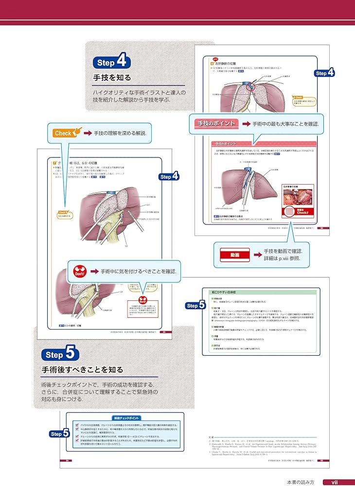 消化器外科手術 肝臓・脾臓 ~標準手技をイラストと動画で学ぶ