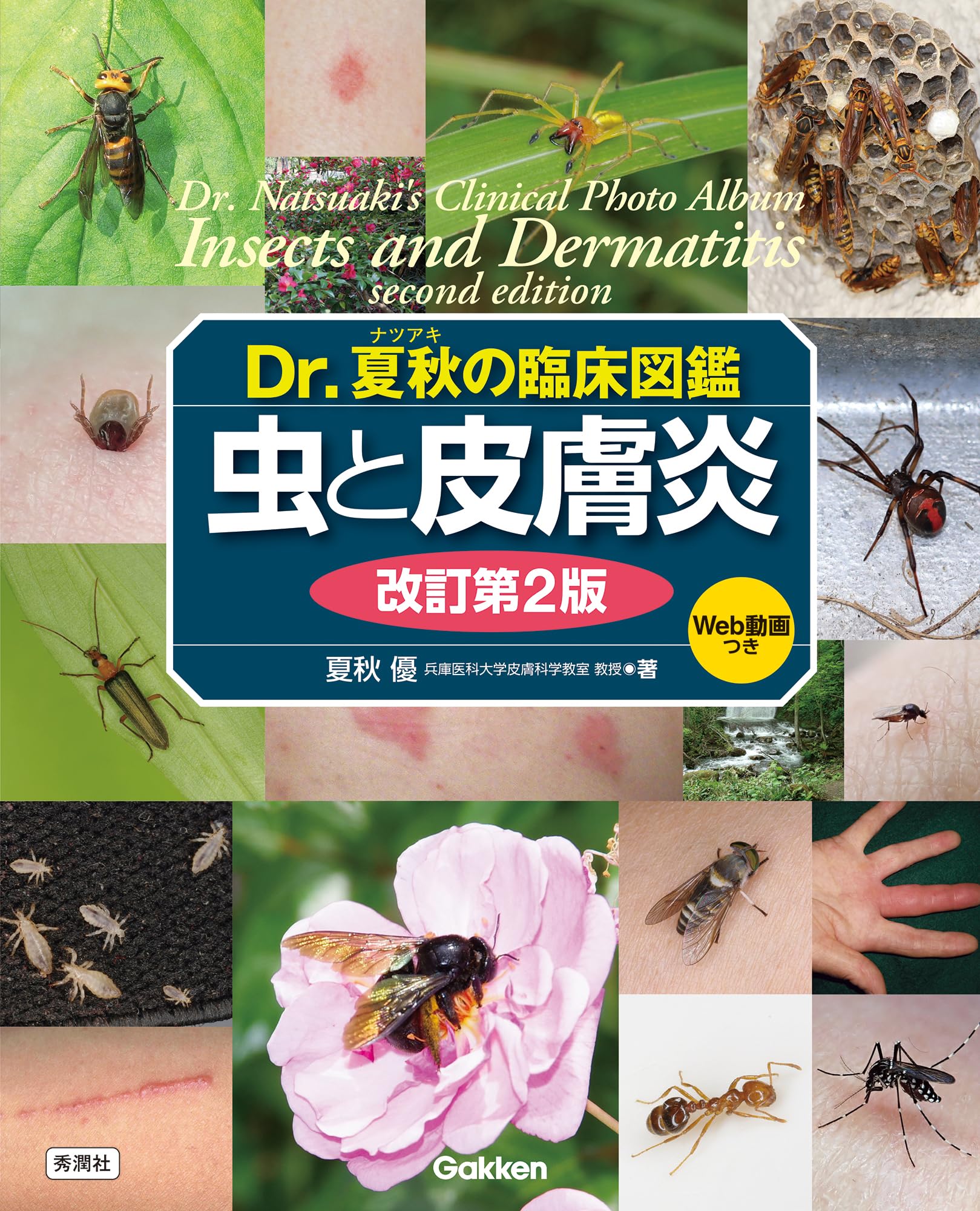 Dr.夏秋の臨床図鑑 虫と皮膚炎 改訂第2版 | 夏秋 優 |本 | 通販 | Amazon