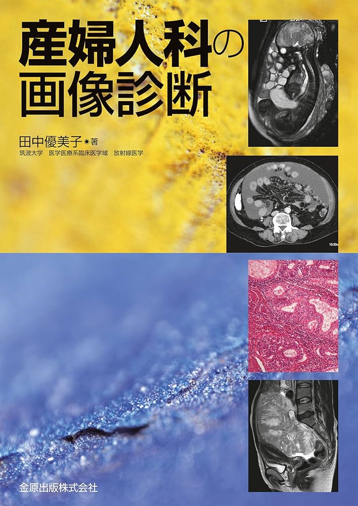 産婦人科の画像診断 | 田中優美子 |本 | 通販 | Amazon