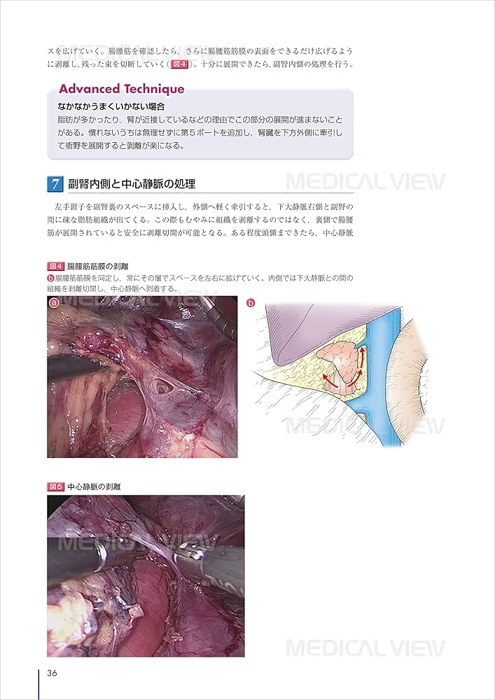 腹腔鏡手術 (Urologic Surgery Next 1) | 荒井 陽一 |本 | 通販 | Amazon