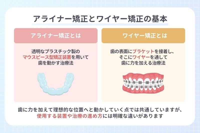 アライナー矯正とワイヤー矯正の違いは？あなたに適切な治療法を
