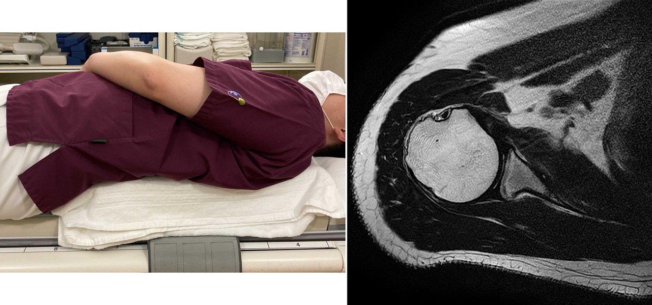 ☆ポジショニングのポイント ～肩関節～ | MRIfan.net