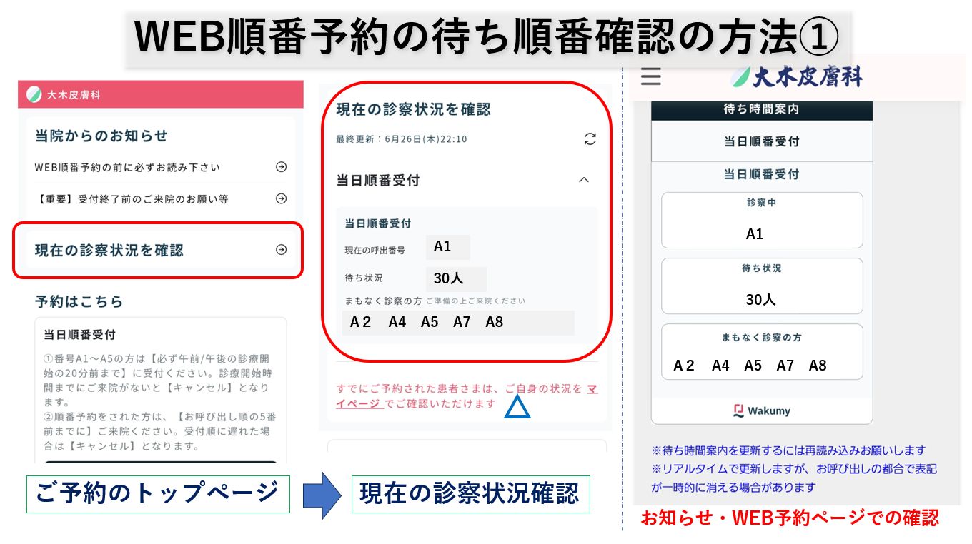 ワクミー予約システム・当日順番予約の確認方法＆FAQ｜大田区大森の