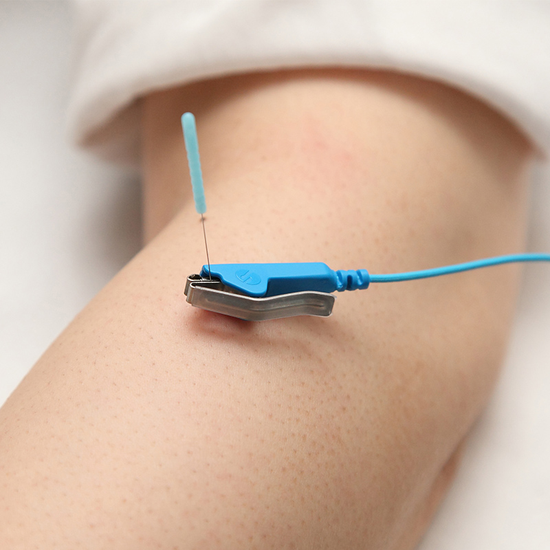 ピコリナ - パルス治療器 - SSP・パルス治療器 - メディカル | きゅあ