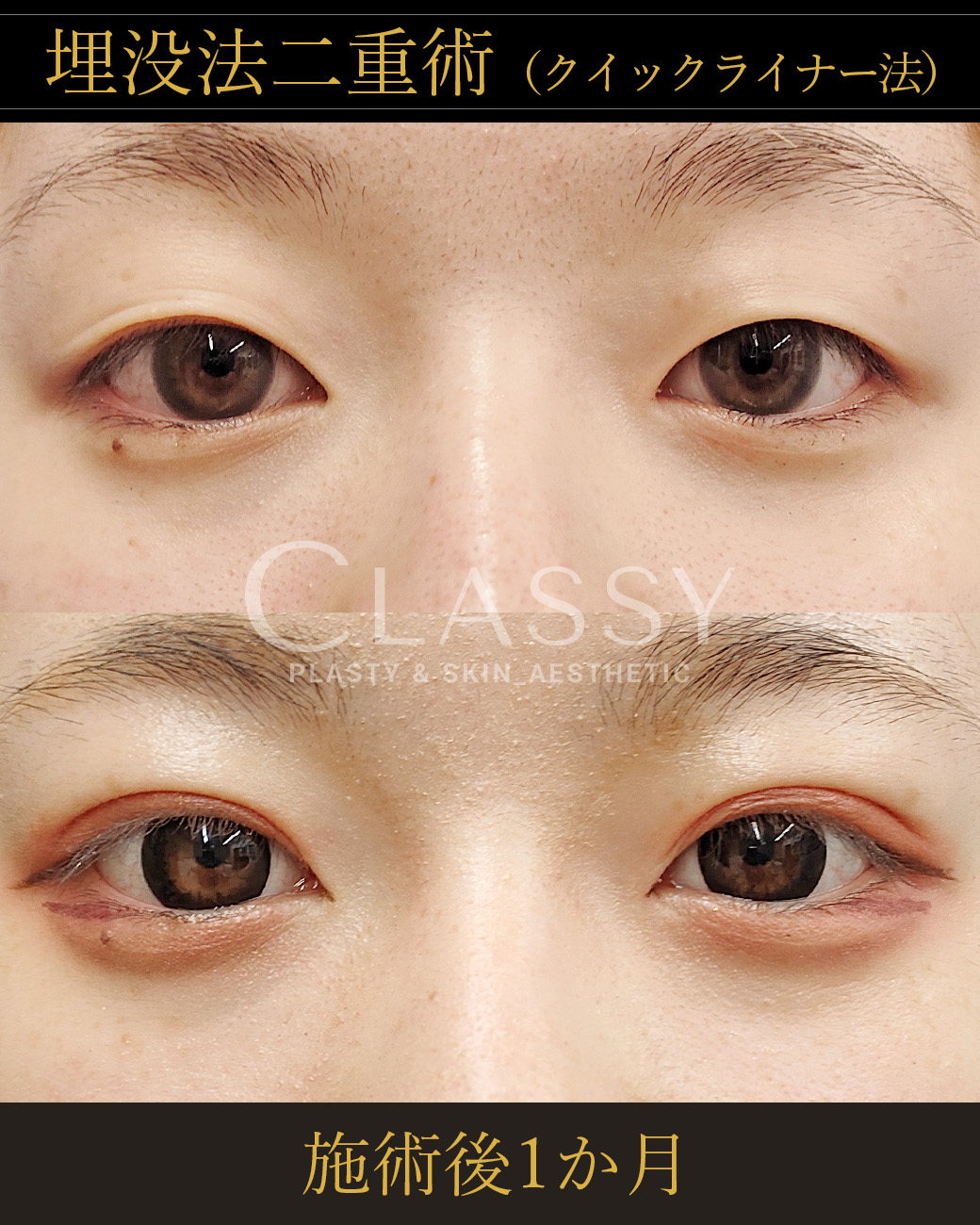 仙台の美容整形外科ならCLASSY仙台美容外科・美容皮膚科®