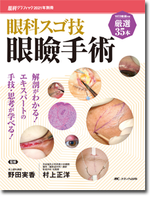 眼科スゴ技 眼瞼手術 | オンラインストア｜看護・医学新刊・セミナー