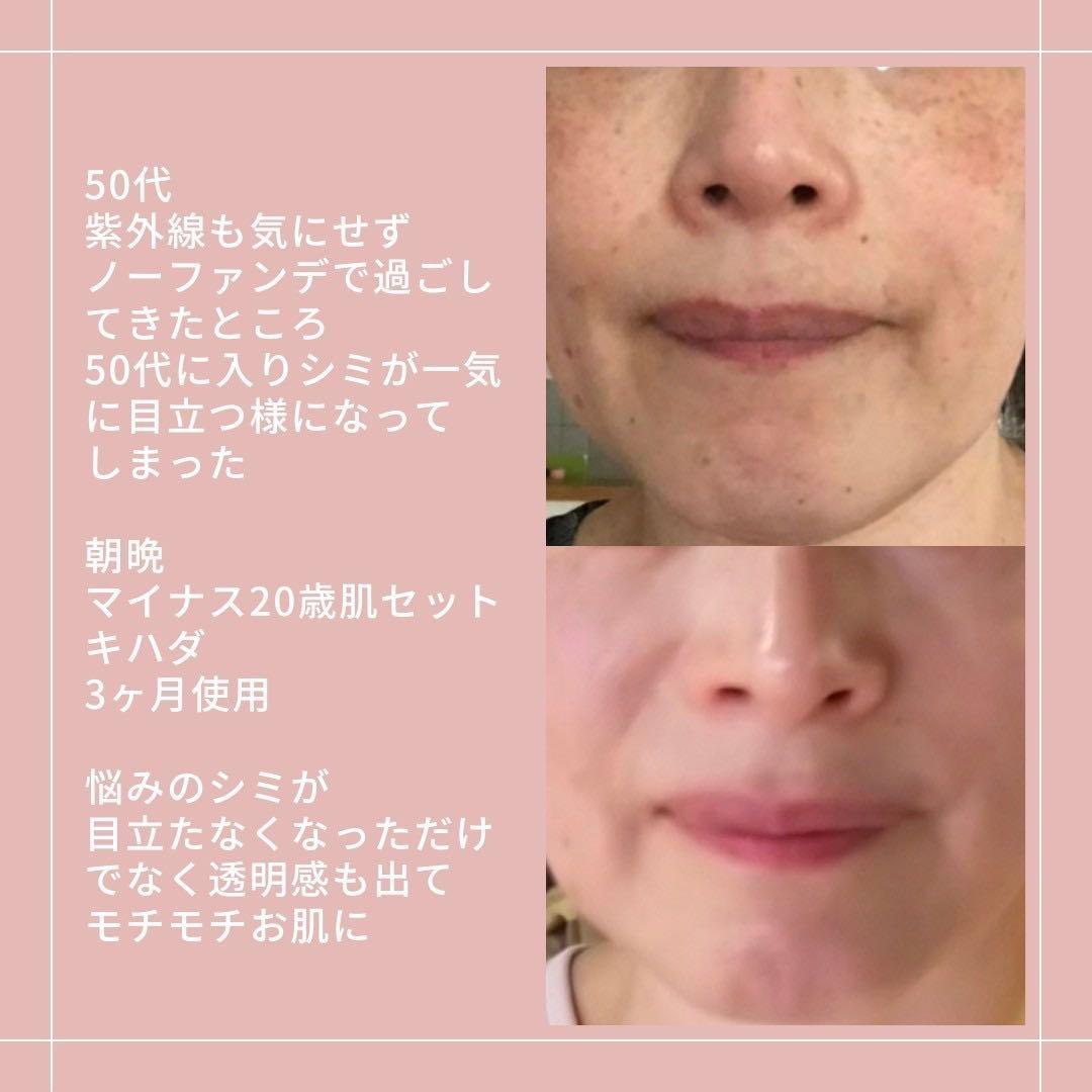 アキノリオ マイナス20歳肌セット ジャー容器ミトNew 選べるサンプル