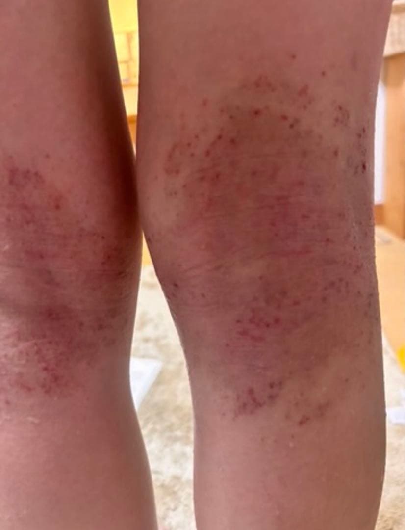 シグナルローション　2本セット