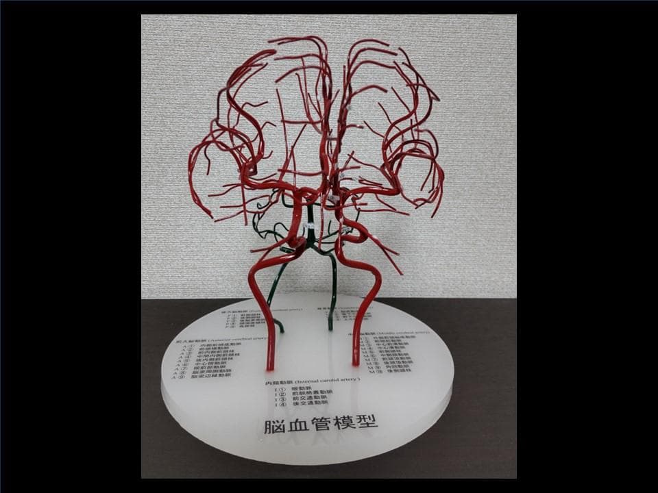 脳血管模型（内頸動脈、椎骨動脈） - メルカリ