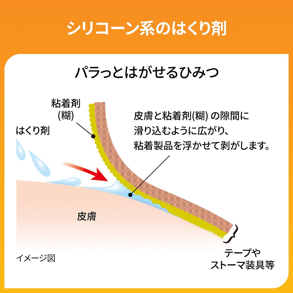 8-9093-12 皮膚用リムーバー キャビロン(TM) 1枚×30包入 TP2 【AXEL