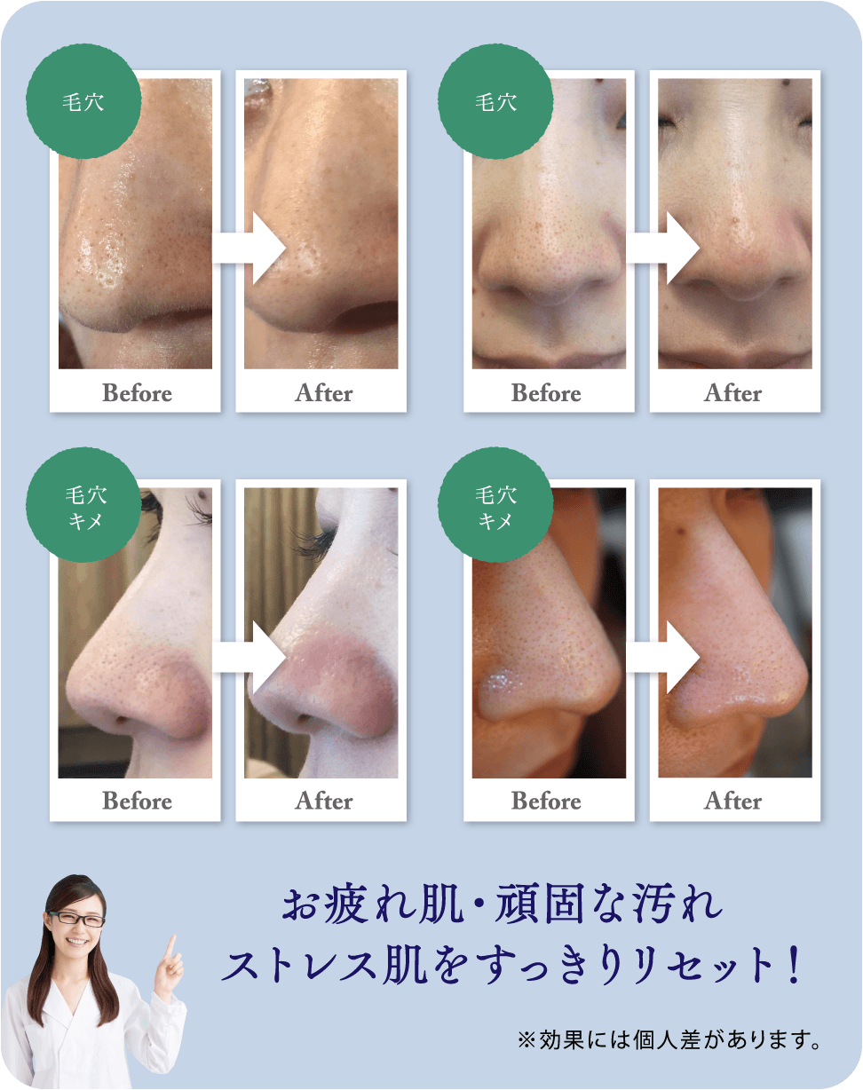 アクアフェイシャル – 西三河の皮膚科・美容皮膚科｜あおい皮フ科