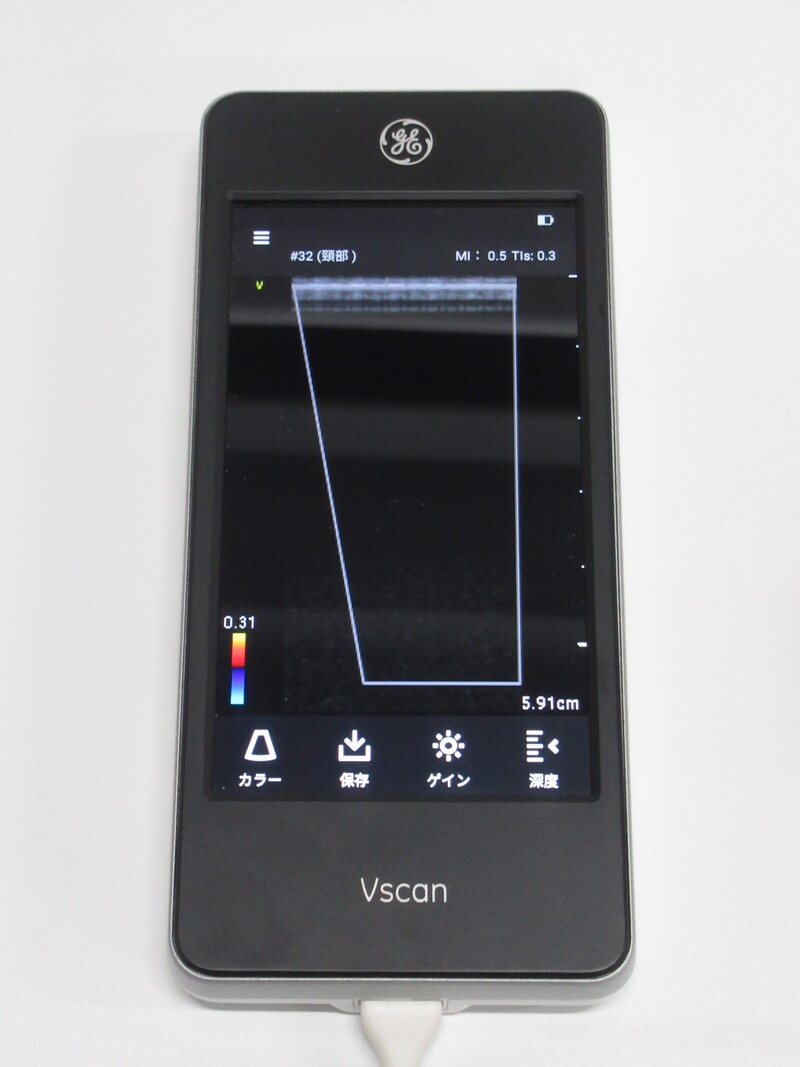 GE Vscan Extend 医療用モニタリング機器 Vscan Extend Portable