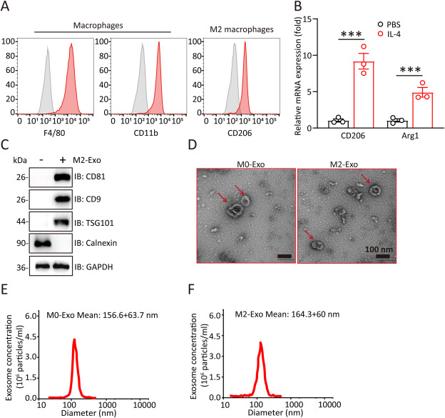 M2 macrophage-derived extracellular vesicles ameliorate