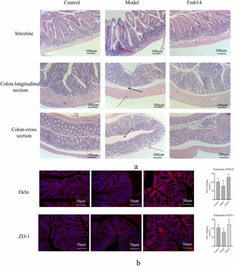 Lacticaseibacillus rhamnosus Fmb14 prevents purine induced