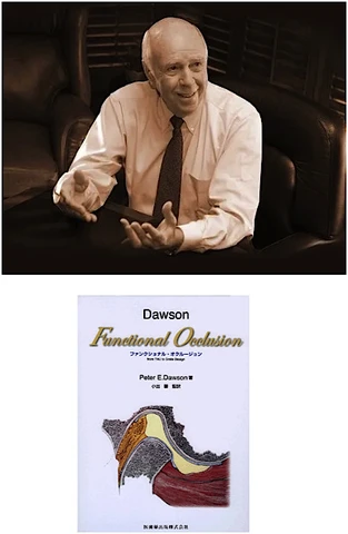 ファンクショナル・オクルージョン